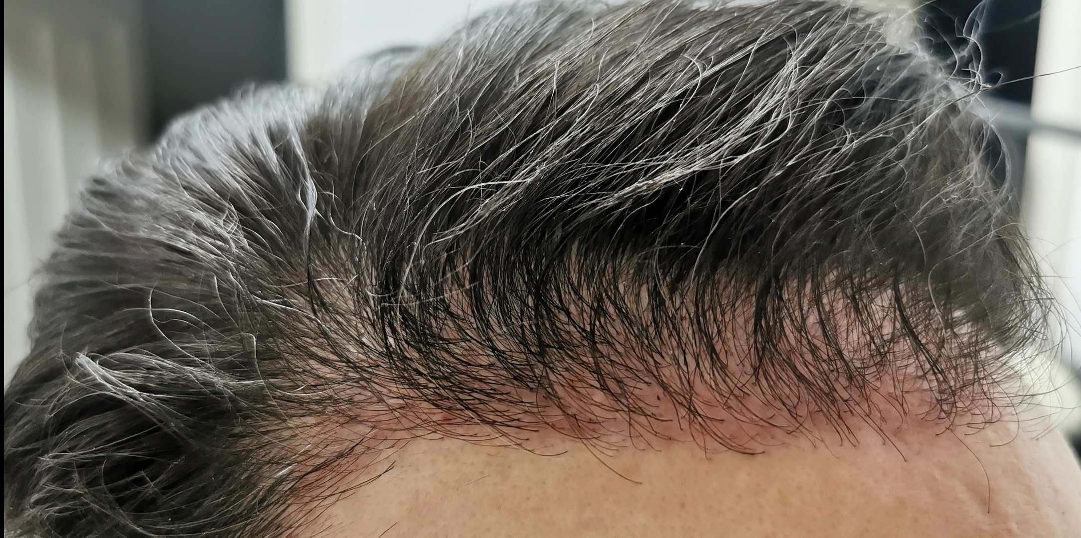 /foren/transplant/index.php/fa/57632/0/