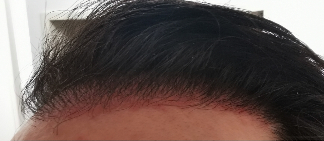 /foren/transplant/index.php/fa/57633/0/