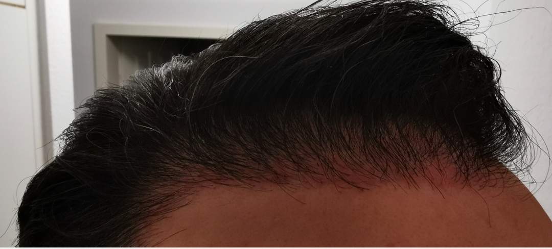 /foren/transplant/index.php/fa/57634/0/