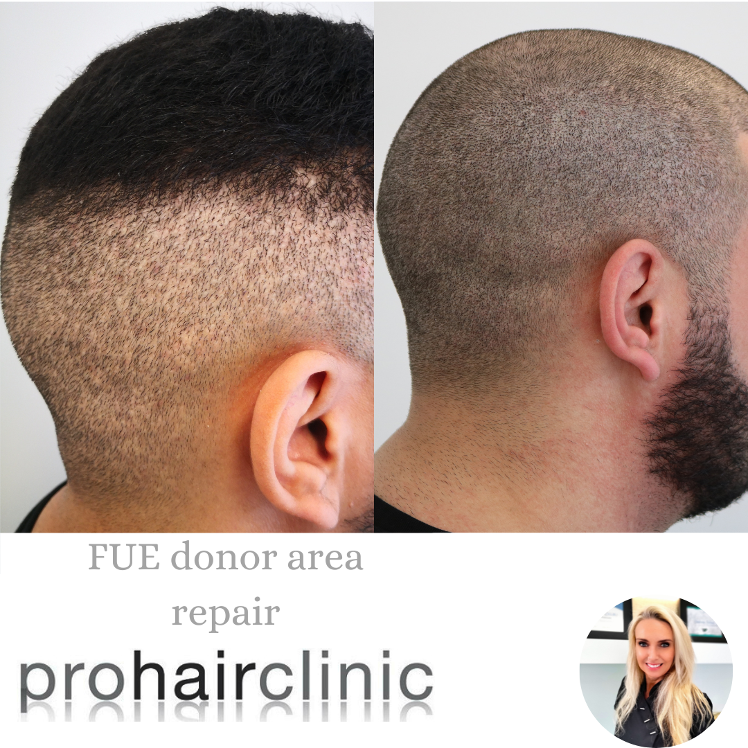 /foren/transplant/index.php/fa/57756/0/