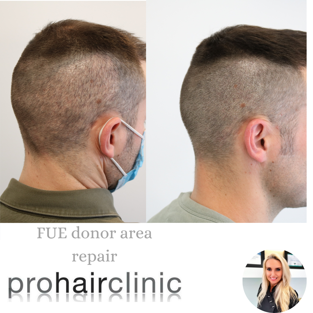 /foren/transplant/index.php/fa/57761/0/