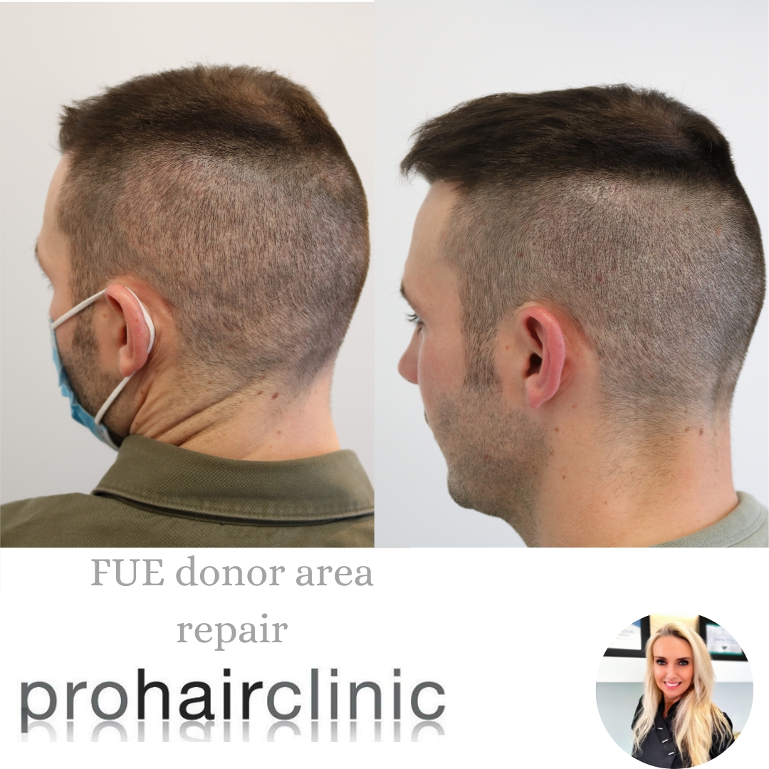 /foren/transplant/index.php/fa/57762/0/