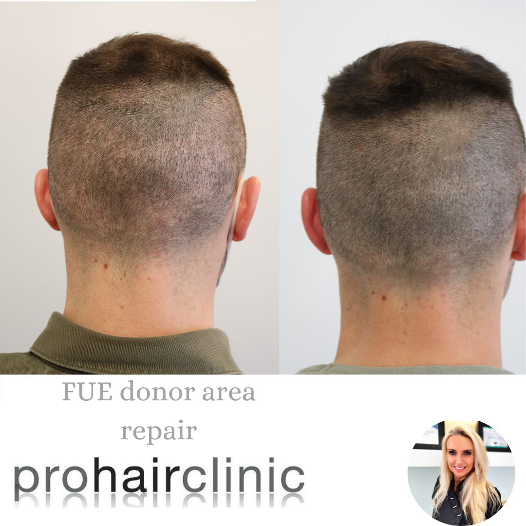 /foren/transplant/index.php/fa/57763/0/