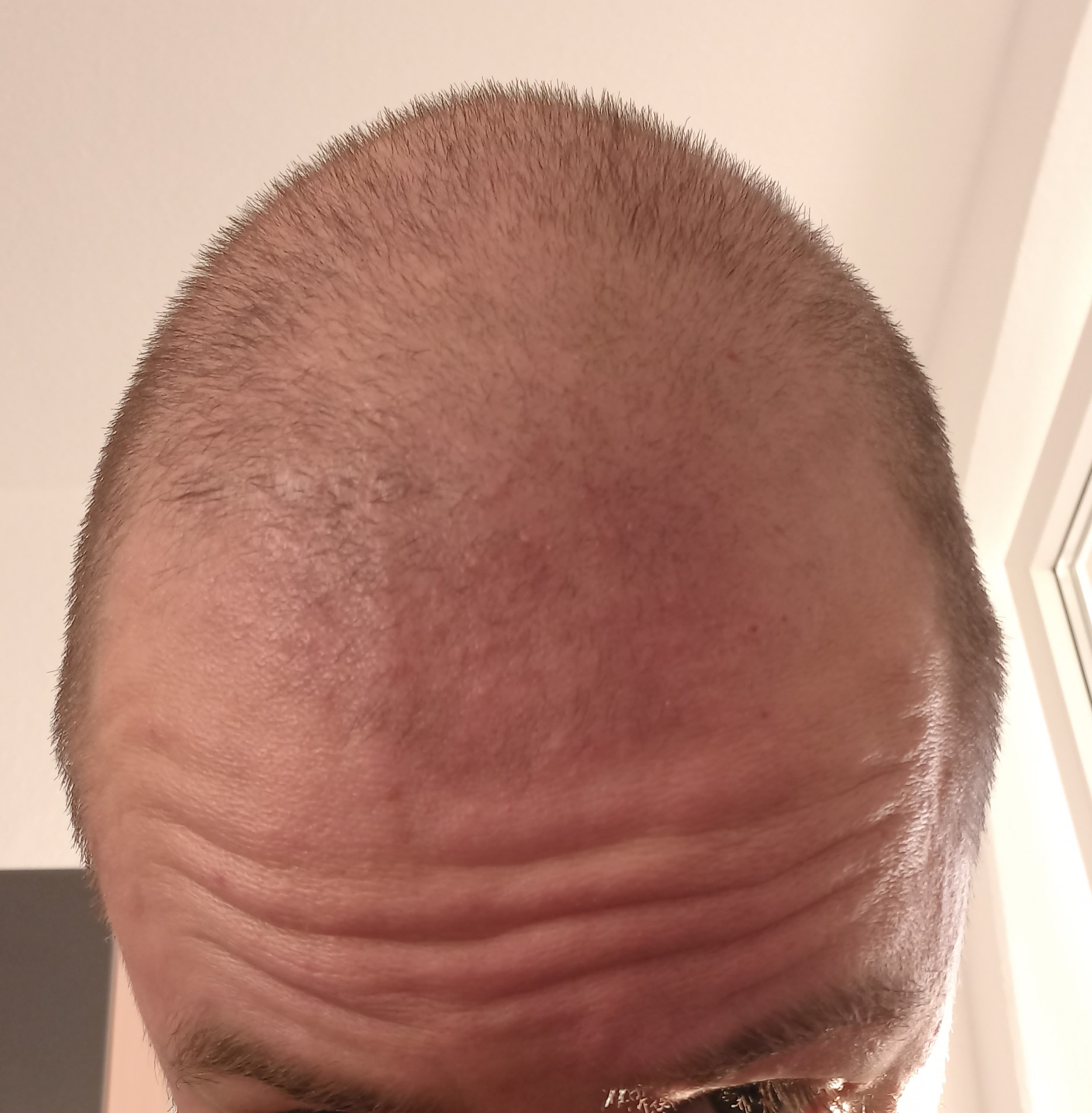 /foren/transplant/index.php/fa/57813/0/