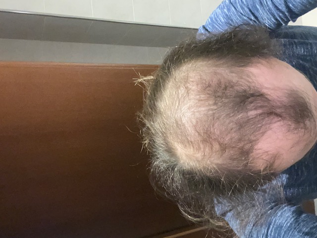 /foren/transplant/index.php/fa/57830/0/