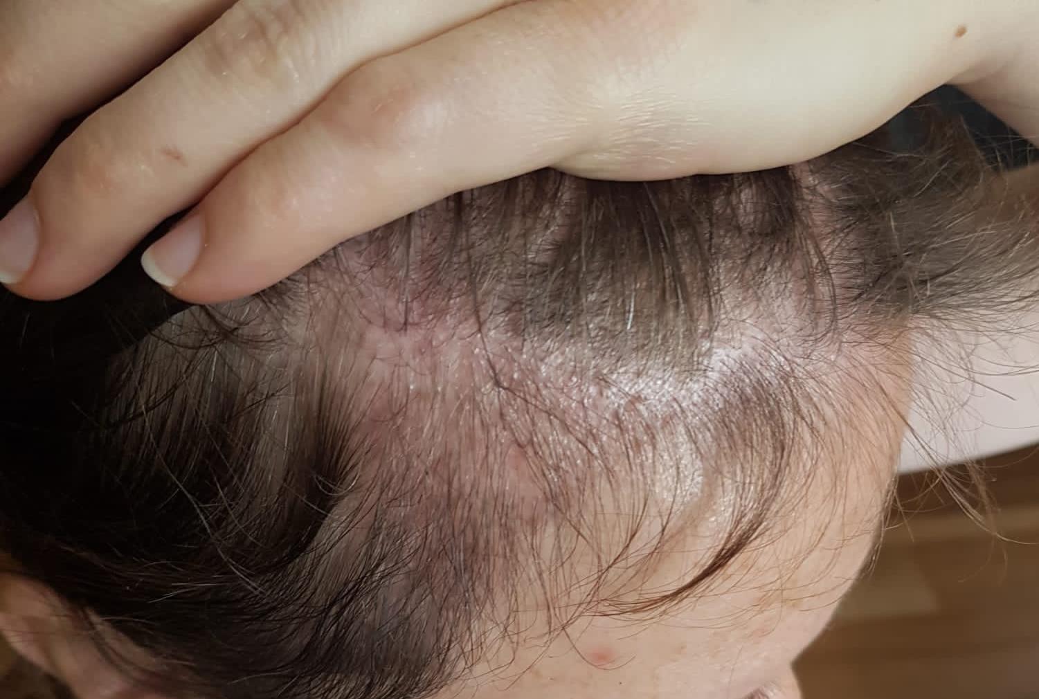 /foren/transplant/index.php/fa/57899/0/