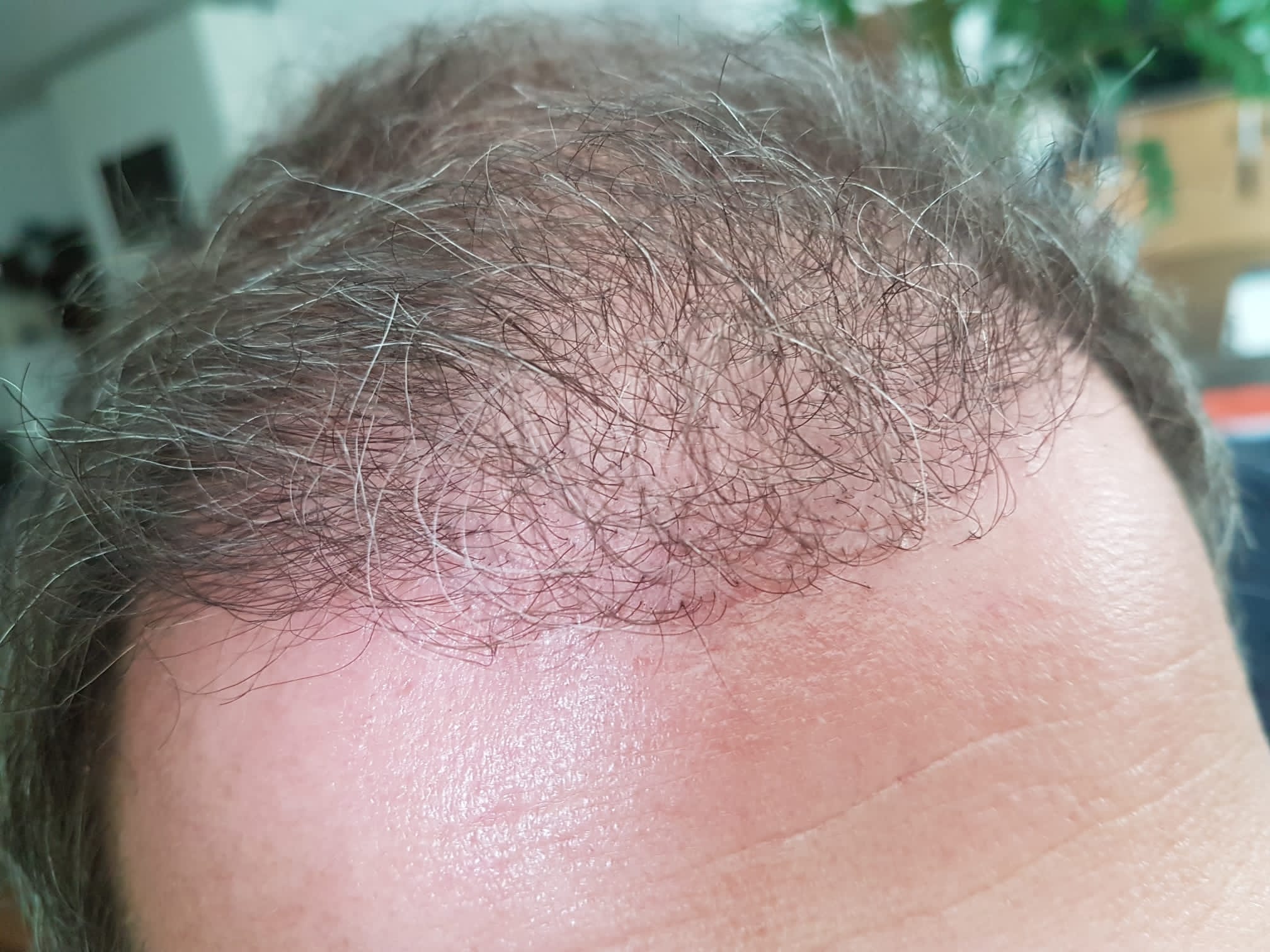 /foren/transplant/index.php/fa/57900/0/