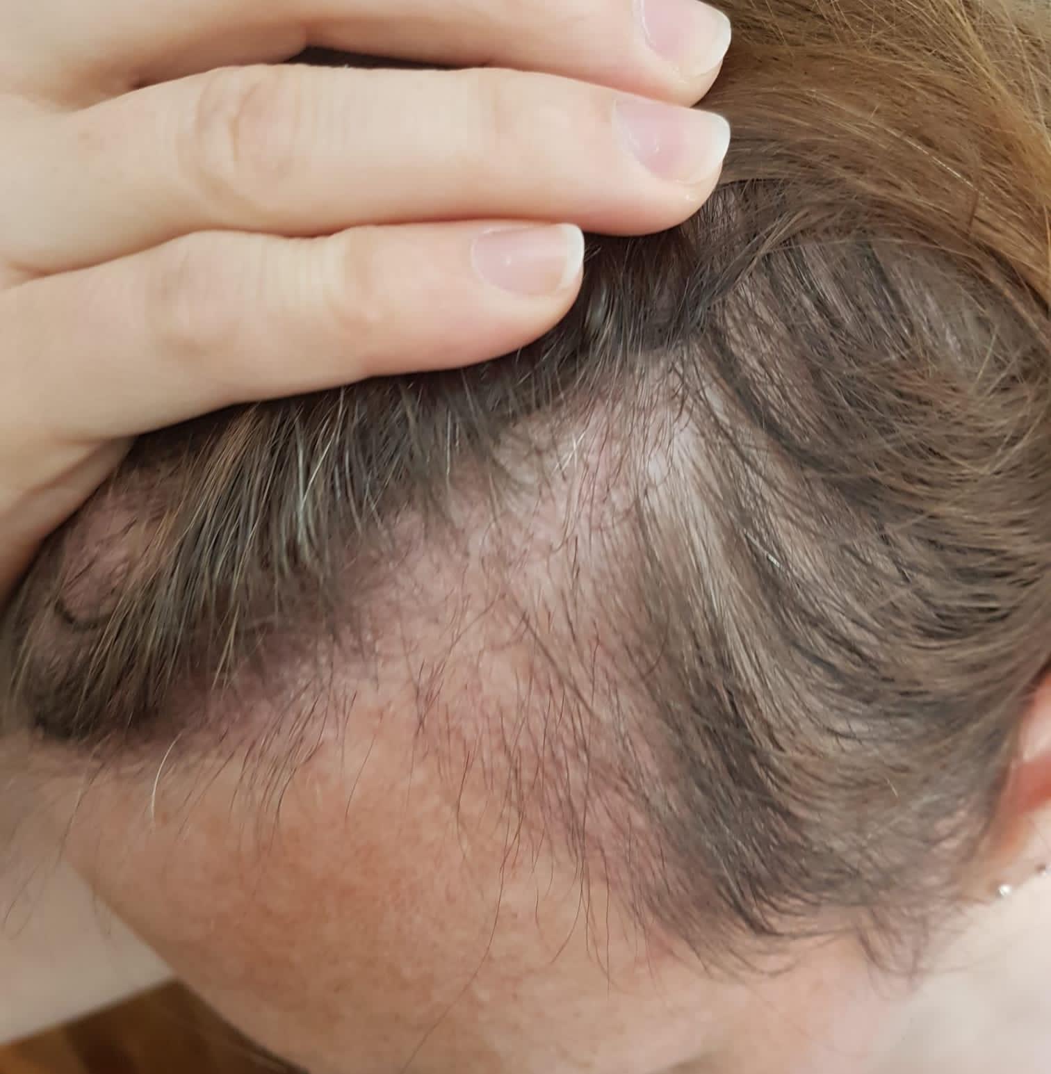 /foren/transplant/index.php/fa/57901/0/