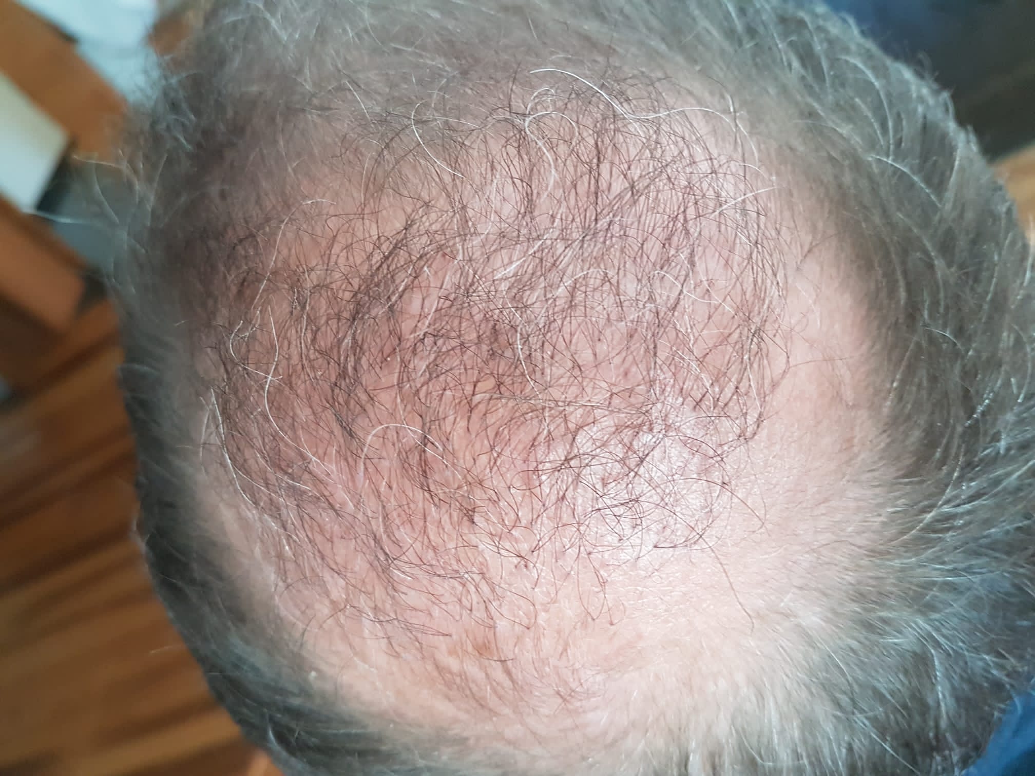 /foren/transplant/index.php/fa/57902/0/