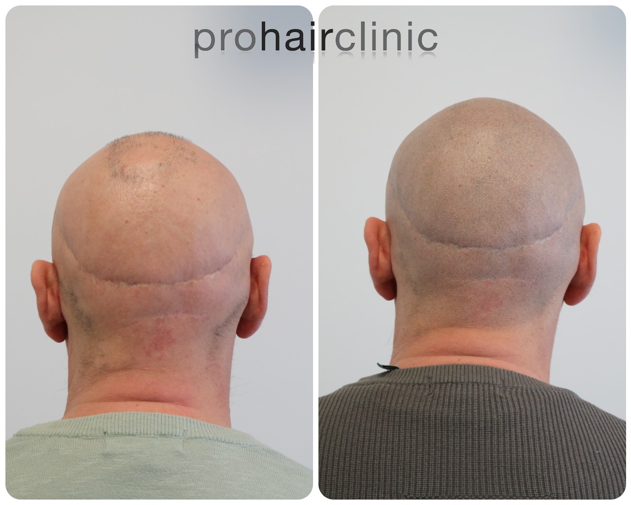 /foren/transplant/index.php/fa/57934/0/