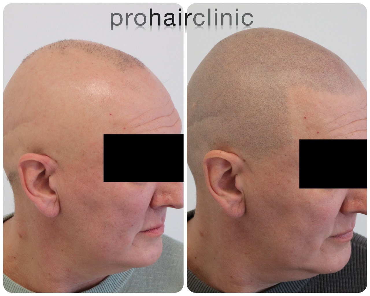 /foren/transplant/index.php/fa/57935/0/