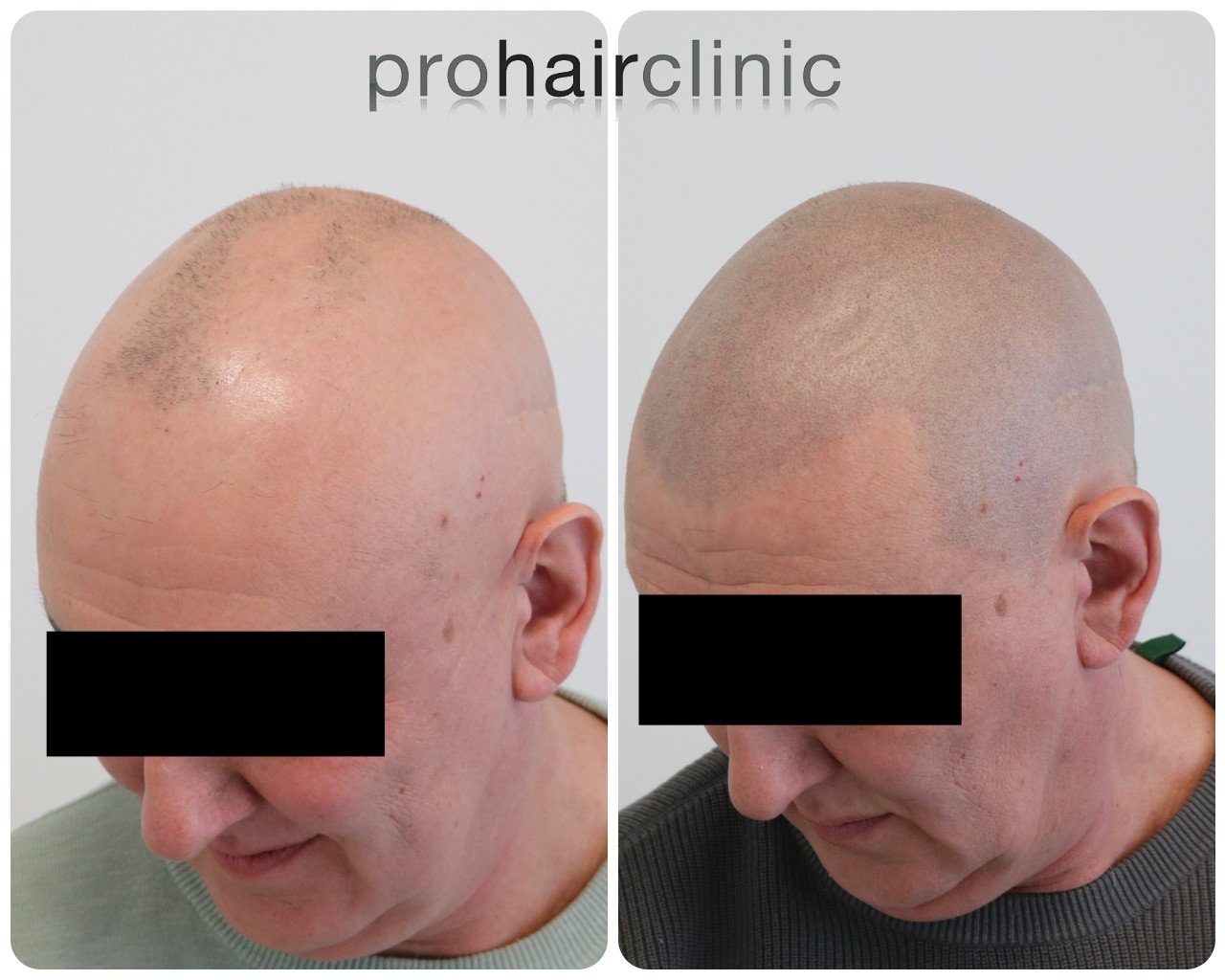 /foren/transplant/index.php/fa/57936/0/