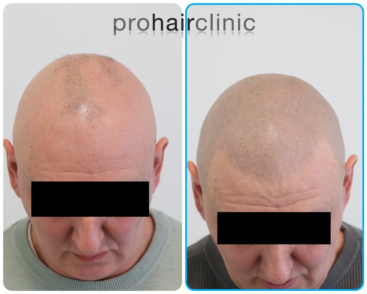 /foren/transplant/index.php/fa/57937/0/