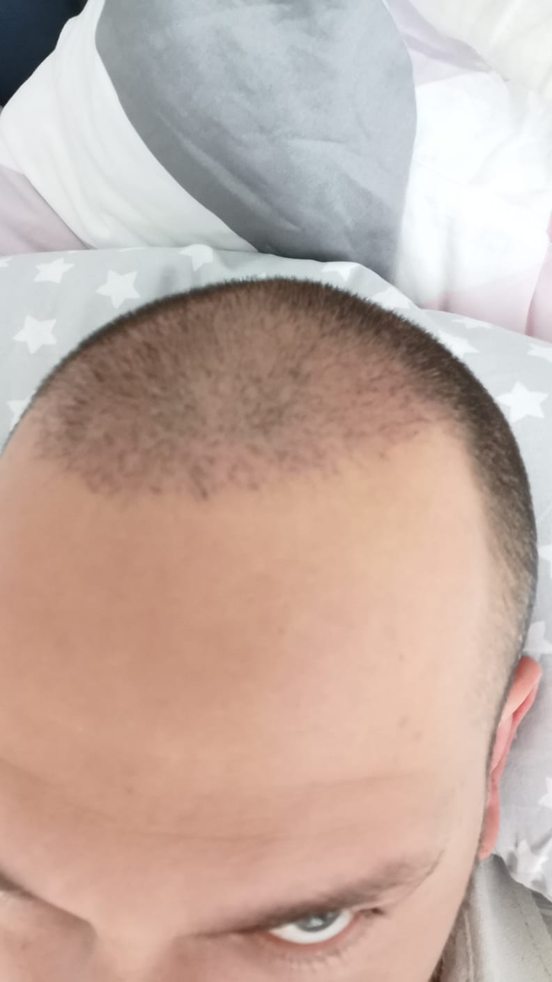 /foren/transplant/index.php/fa/58001/0/