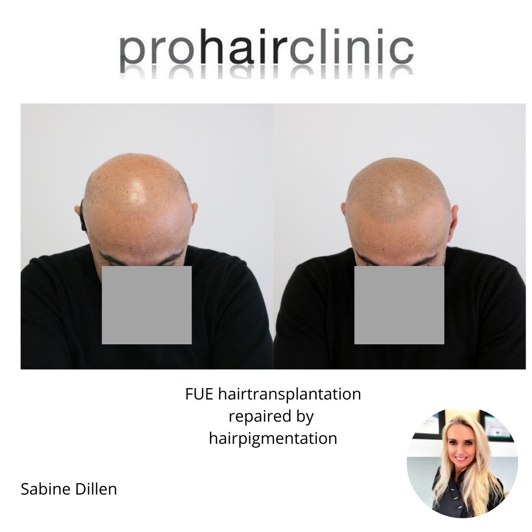 /foren/transplant/index.php/fa/58094/0/