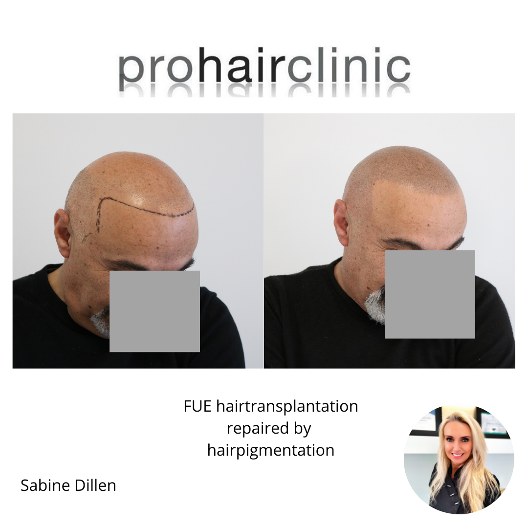 /foren/transplant/index.php/fa/58095/0/