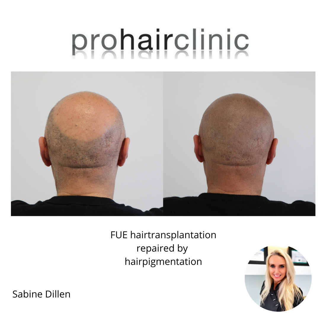 /foren/transplant/index.php/fa/58096/0/