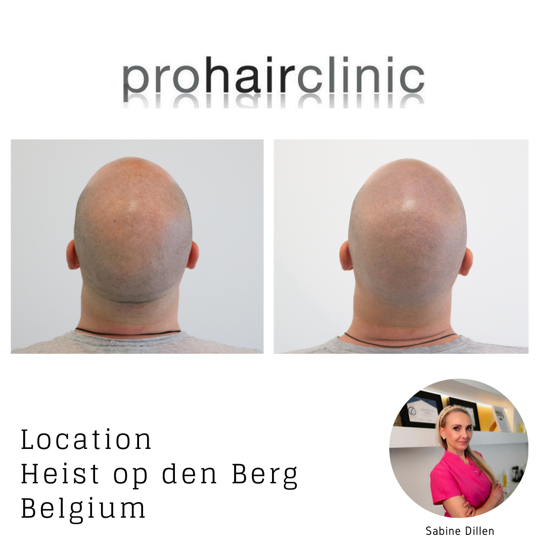 /foren/transplant/index.php/fa/58131/0/