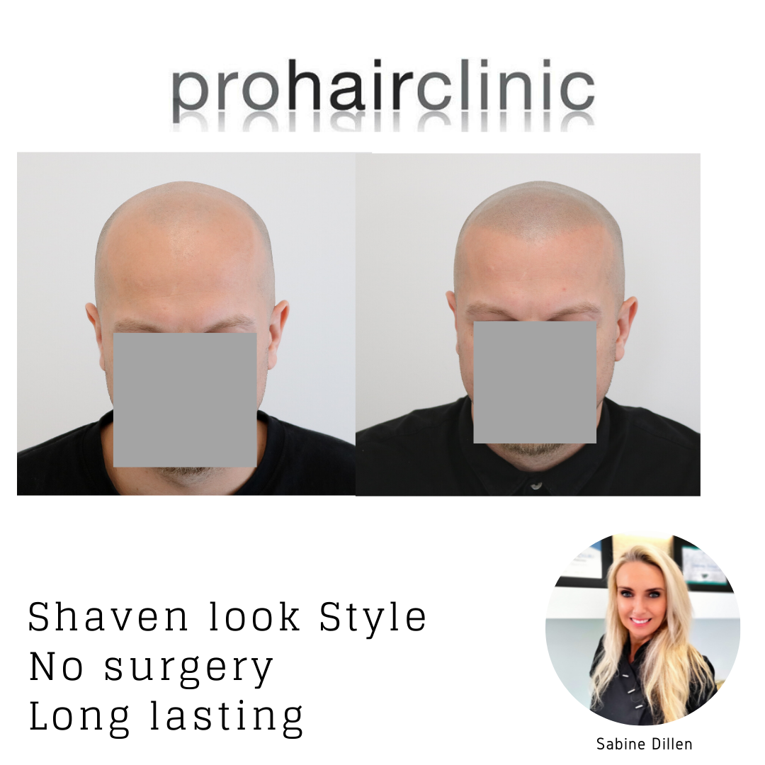 /foren/transplant/index.php/fa/58181/0/