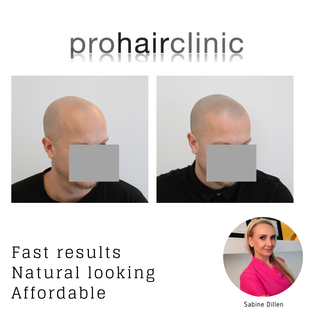 /foren/transplant/index.php/fa/58182/0/