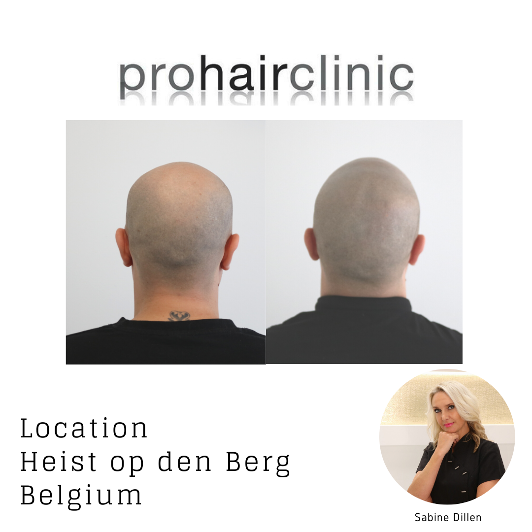 /foren/transplant/index.php/fa/58184/0/