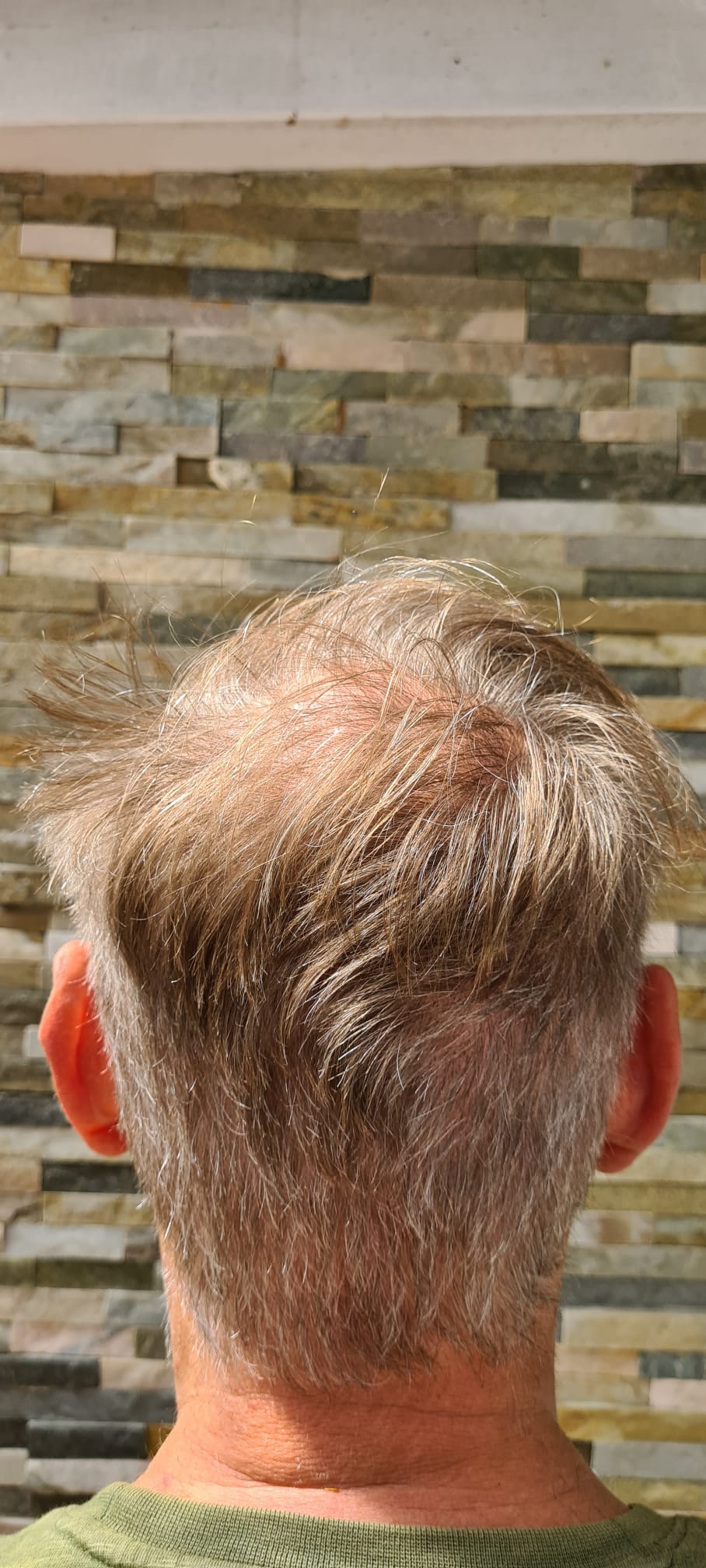 /foren/transplant/index.php/fa/58200/0/