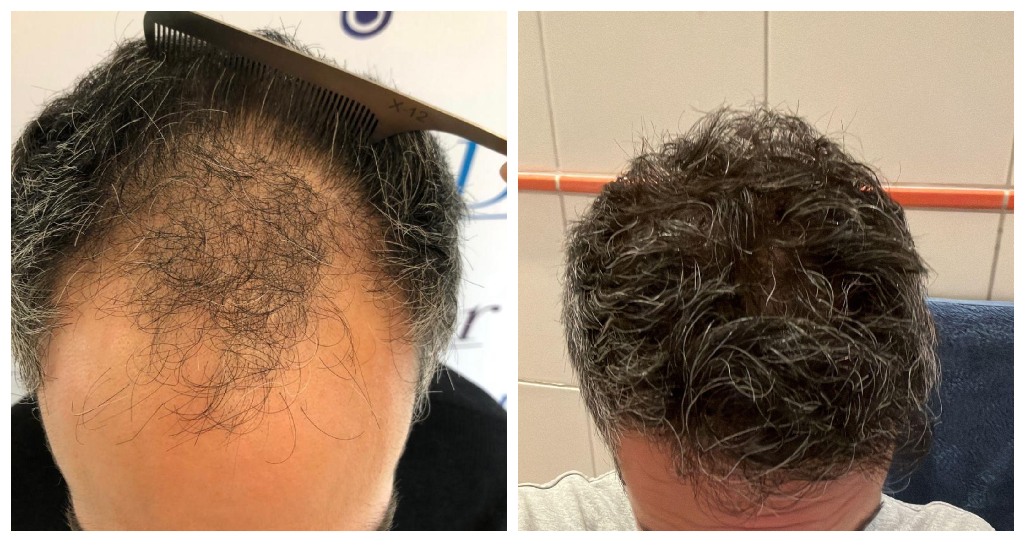 /foren/transplant/index.php/fa/58258/0/