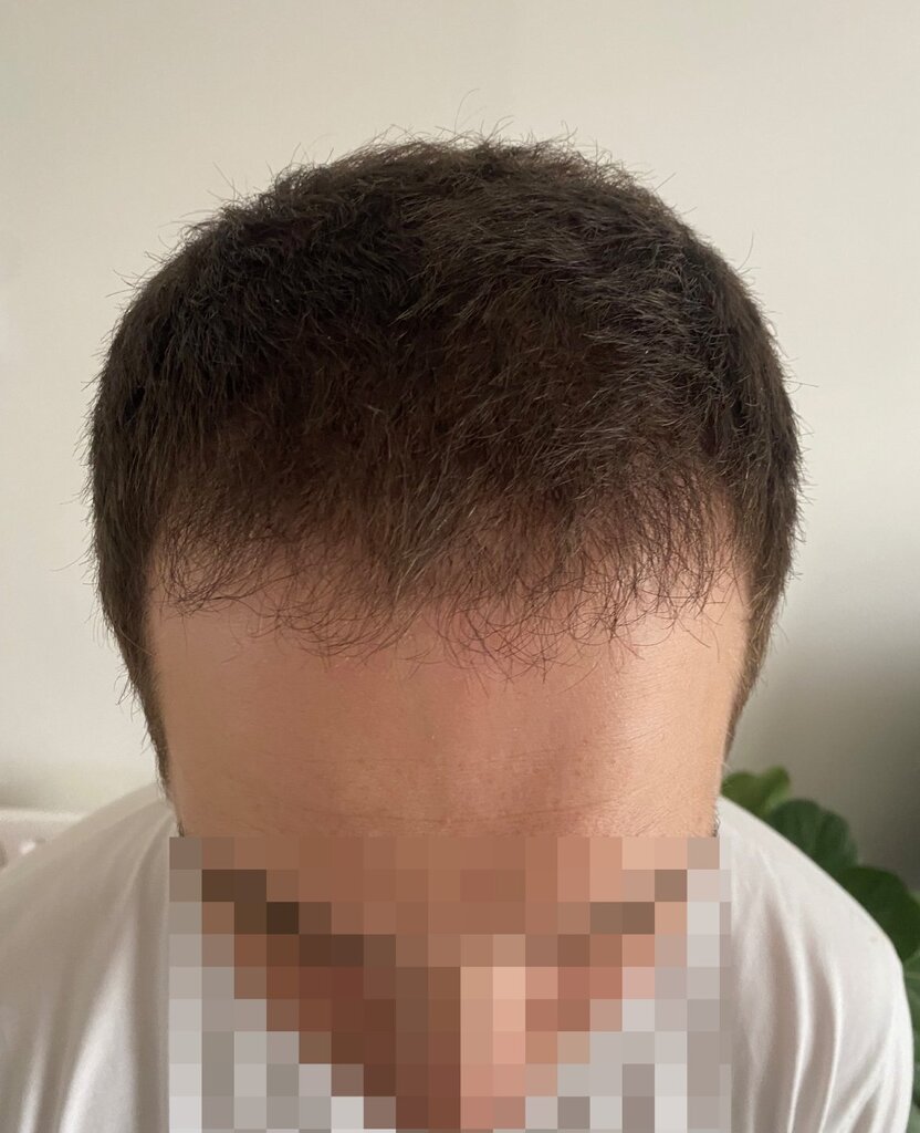 /foren/transplant/index.php/fa/58354/0/