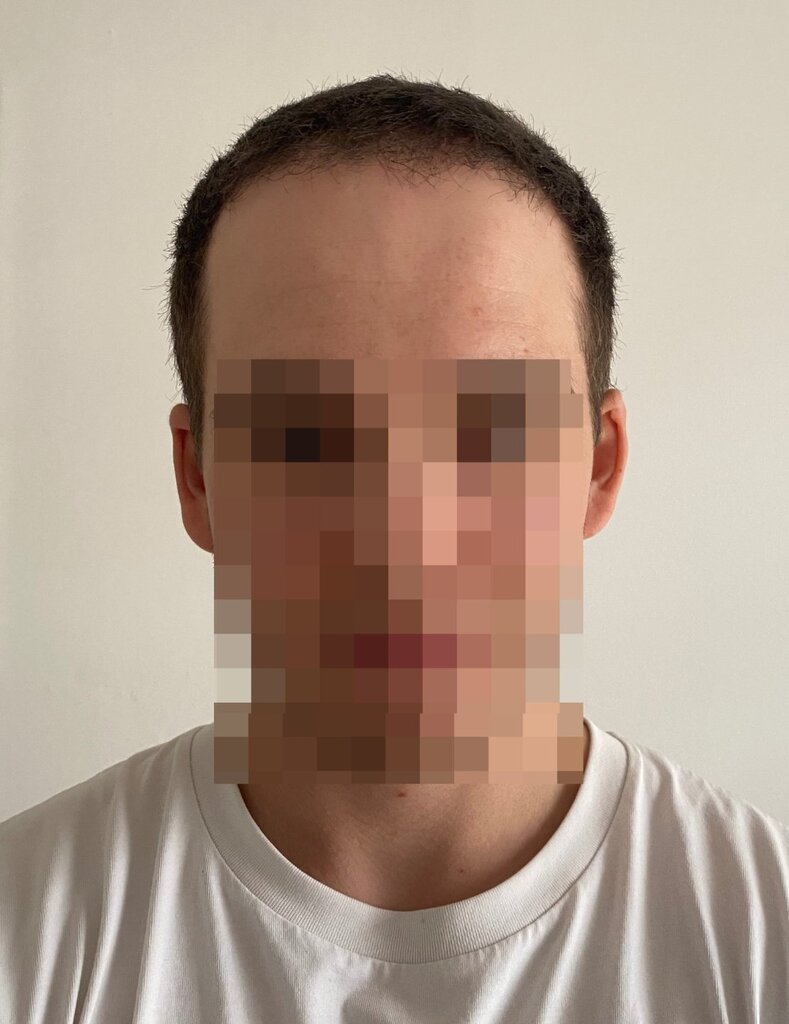 /foren/transplant/index.php/fa/58355/0/