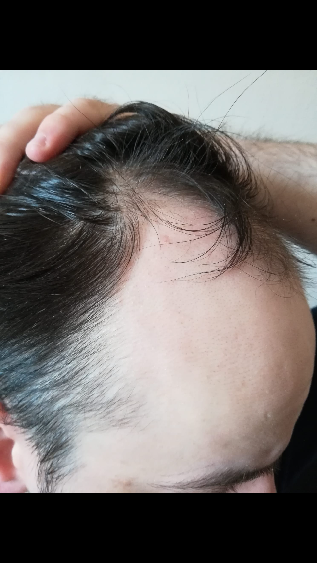 /foren/transplant/index.php/fa/58366/0/