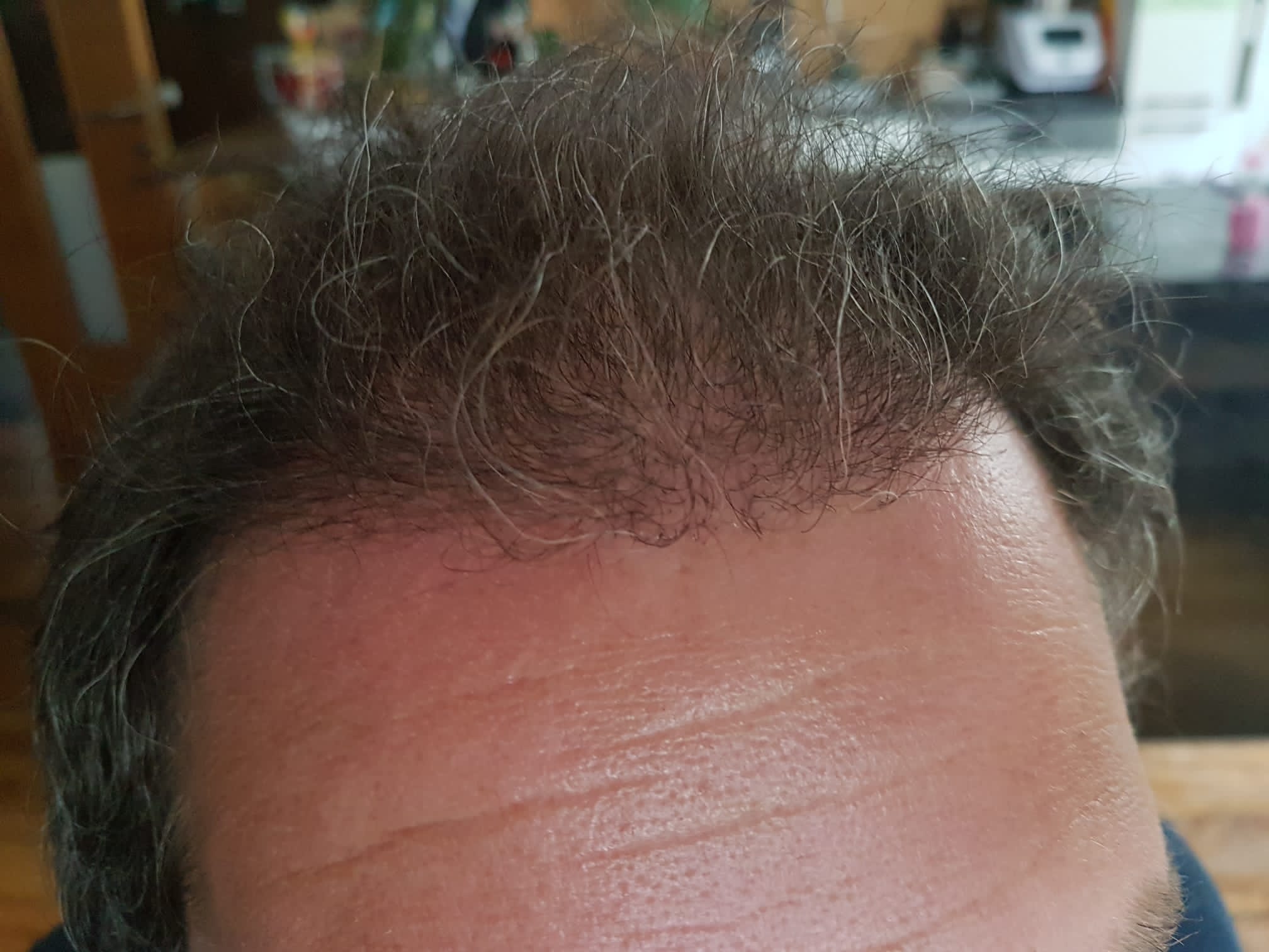 /foren/transplant/index.php/fa/58441/0/