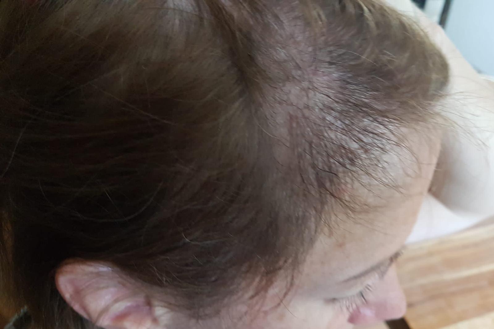 /foren/transplant/index.php/fa/58442/0/