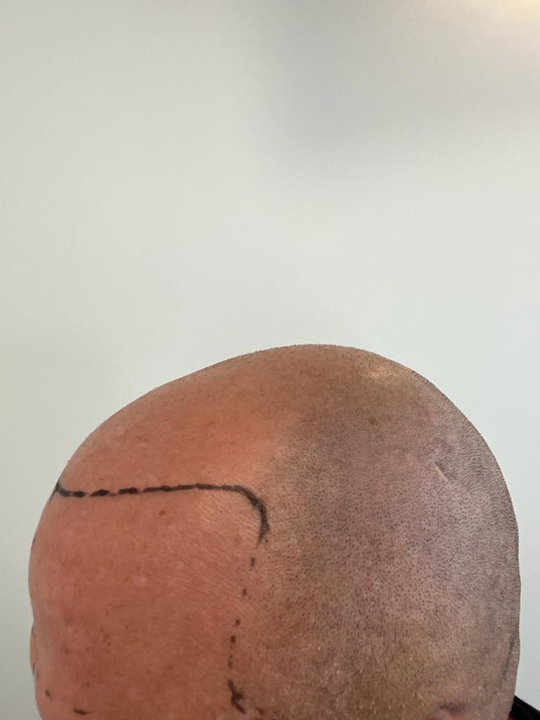 /foren/transplant/index.php/fa/58496/0/