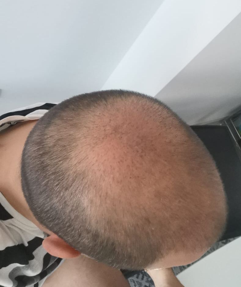 /foren/transplant/index.php/fa/58556/0/