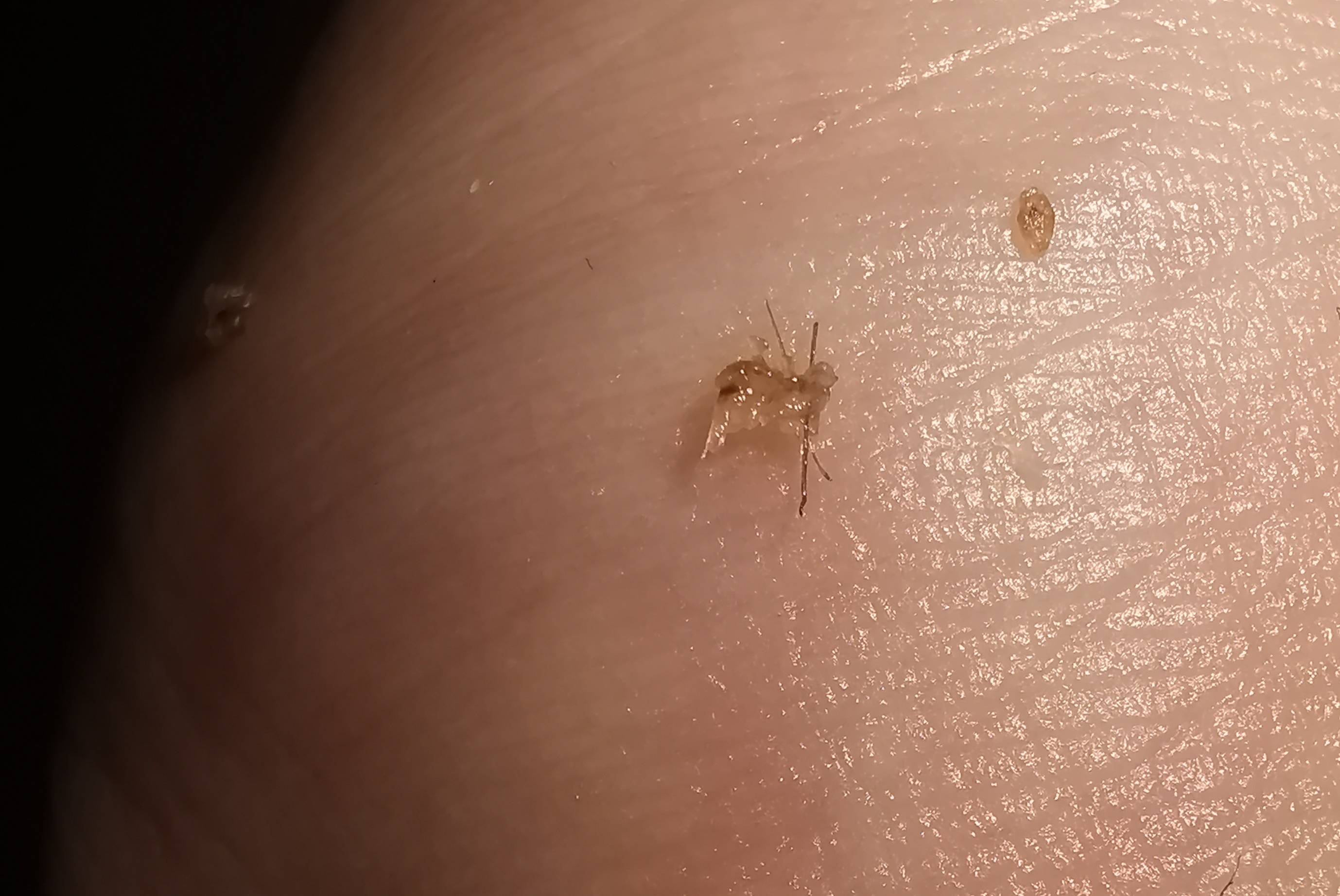 /foren/transplant/index.php/fa/58675/0/