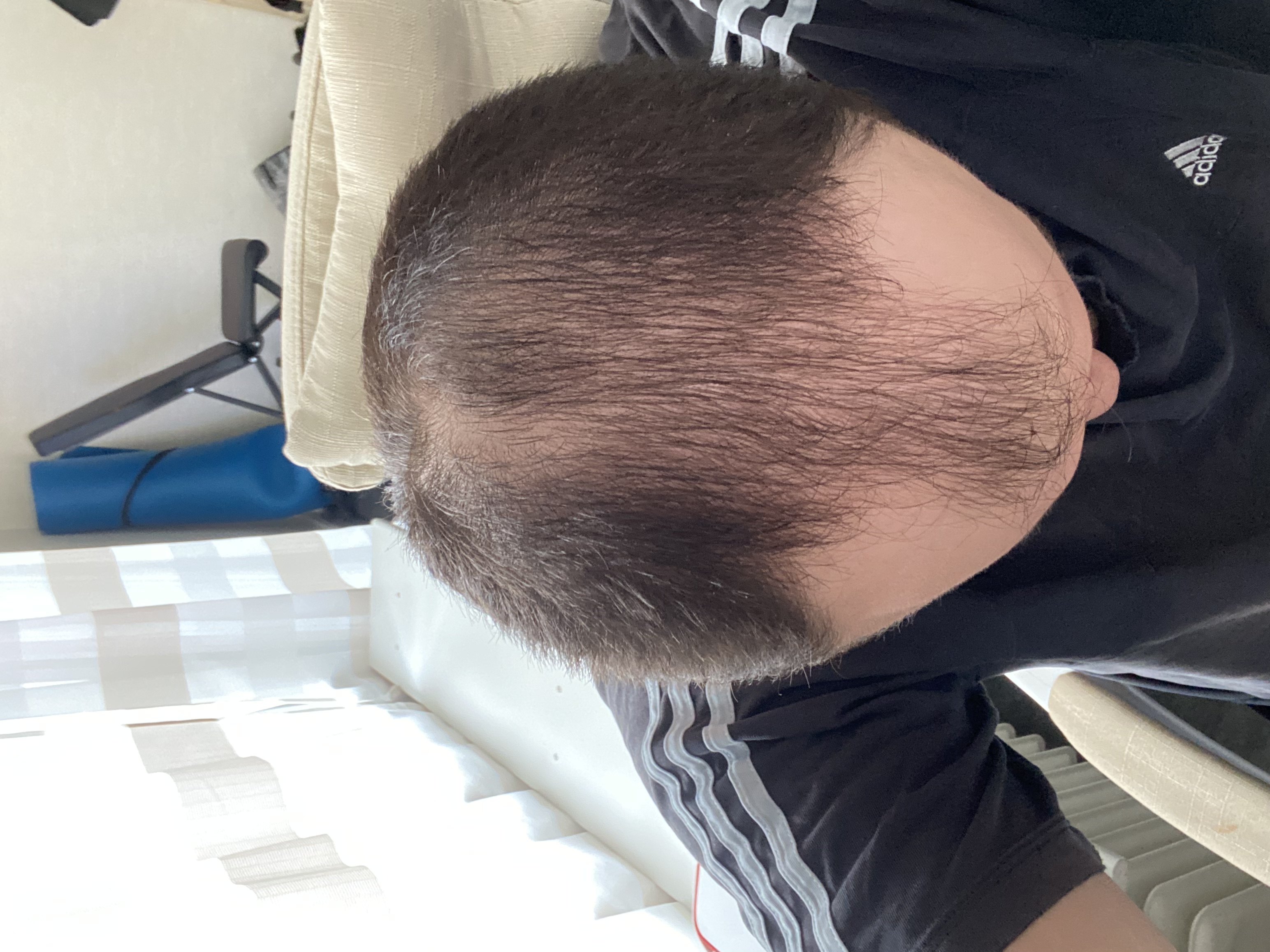 /foren/transplant/index.php/fa/58691/0/