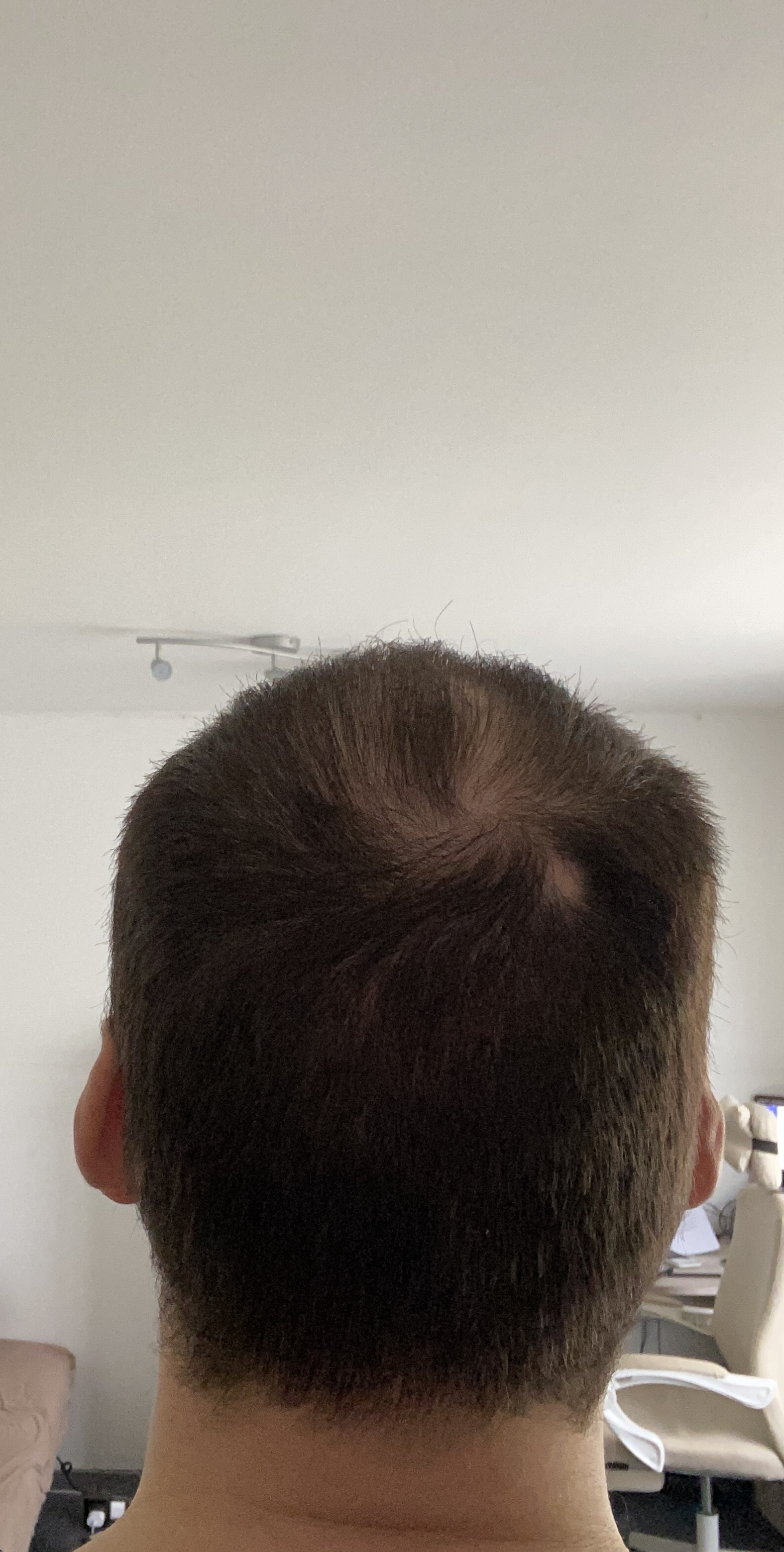 /foren/transplant/index.php/fa/58692/0/