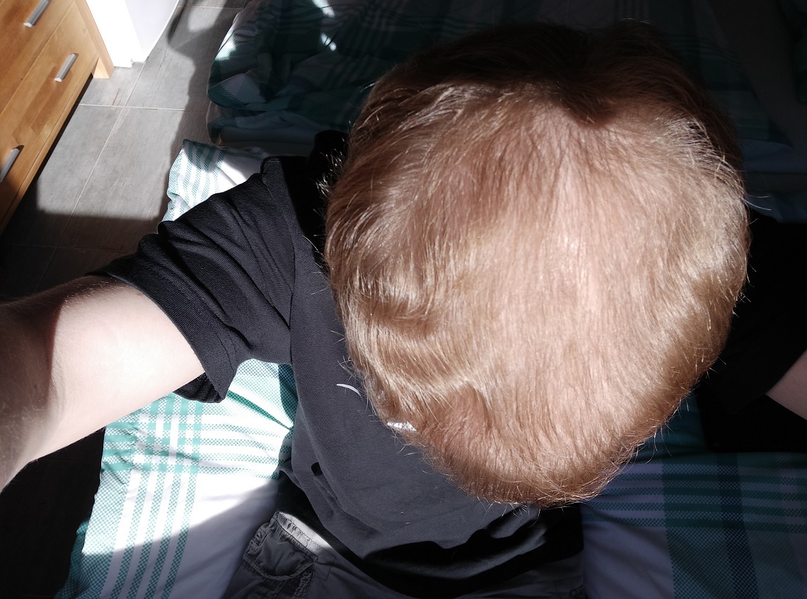 /foren/transplant/index.php/fa/58701/0/