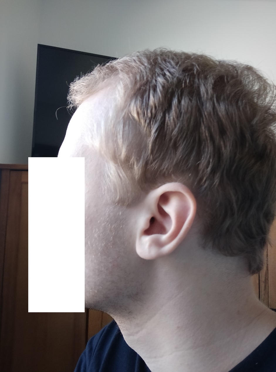 /foren/transplant/index.php/fa/58703/0/