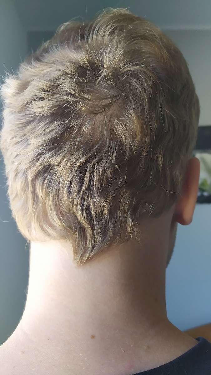 /foren/transplant/index.php/fa/58704/0/