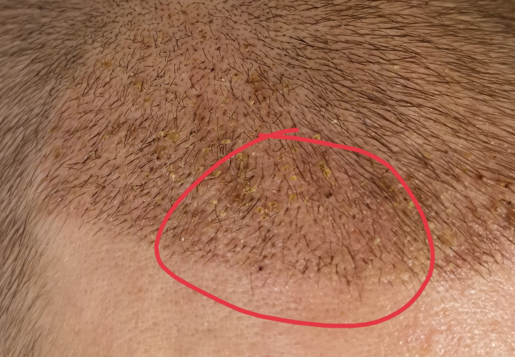 /foren/transplant/index.php/fa/58705/0/