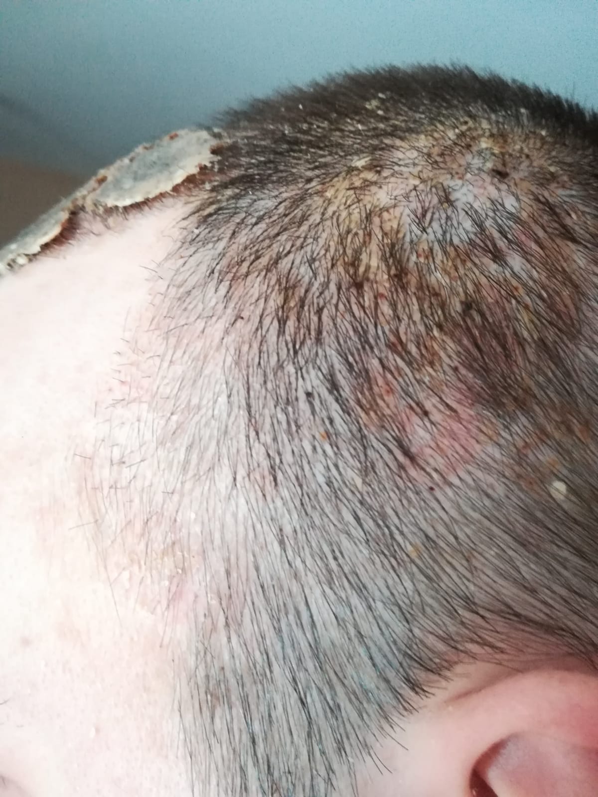 /foren/transplant/index.php/fa/58723/0/