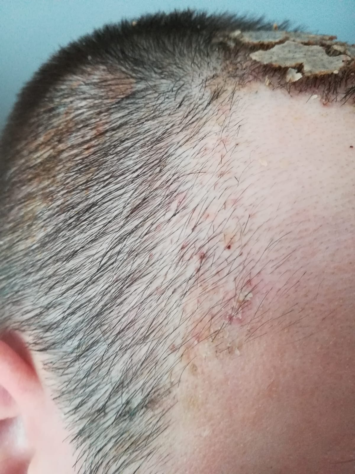 /foren/transplant/index.php/fa/58724/0/