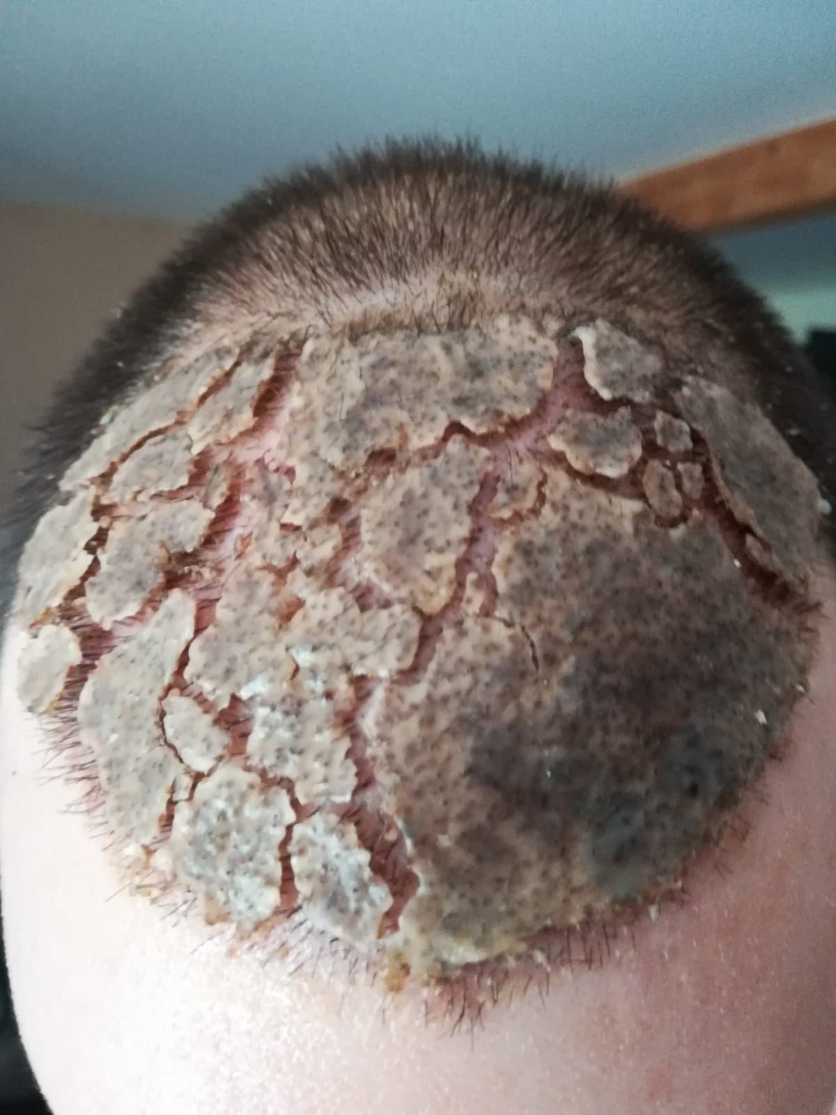 /foren/transplant/index.php/fa/58725/0/