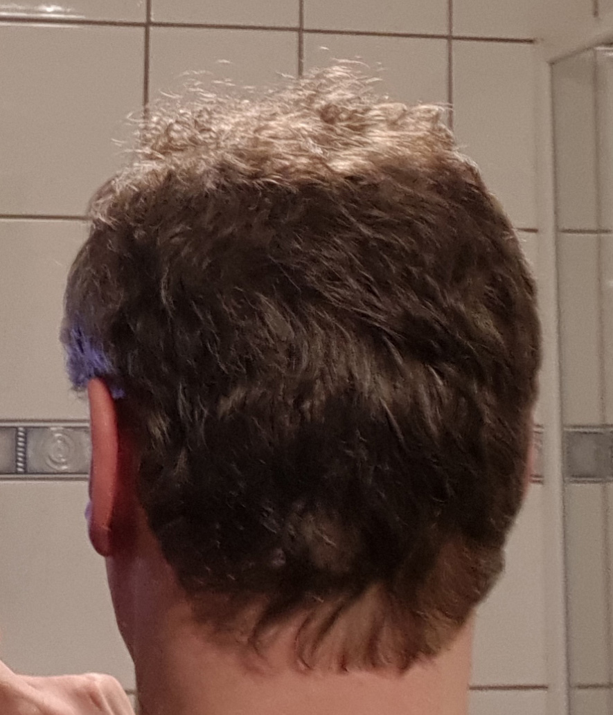 /foren/transplant/index.php/fa/58864/0/