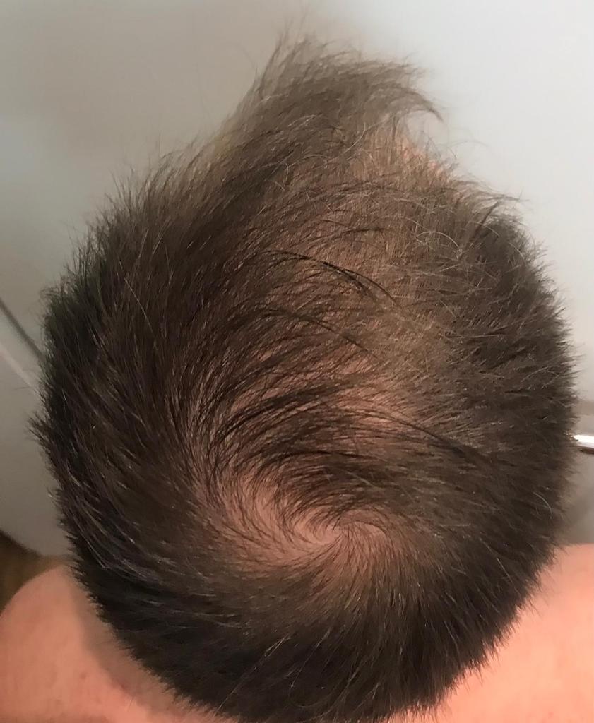 /foren/transplant/index.php/fa/58927/0/