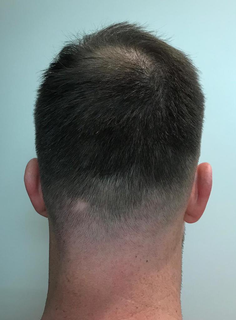 /foren/transplant/index.php/fa/58928/0/