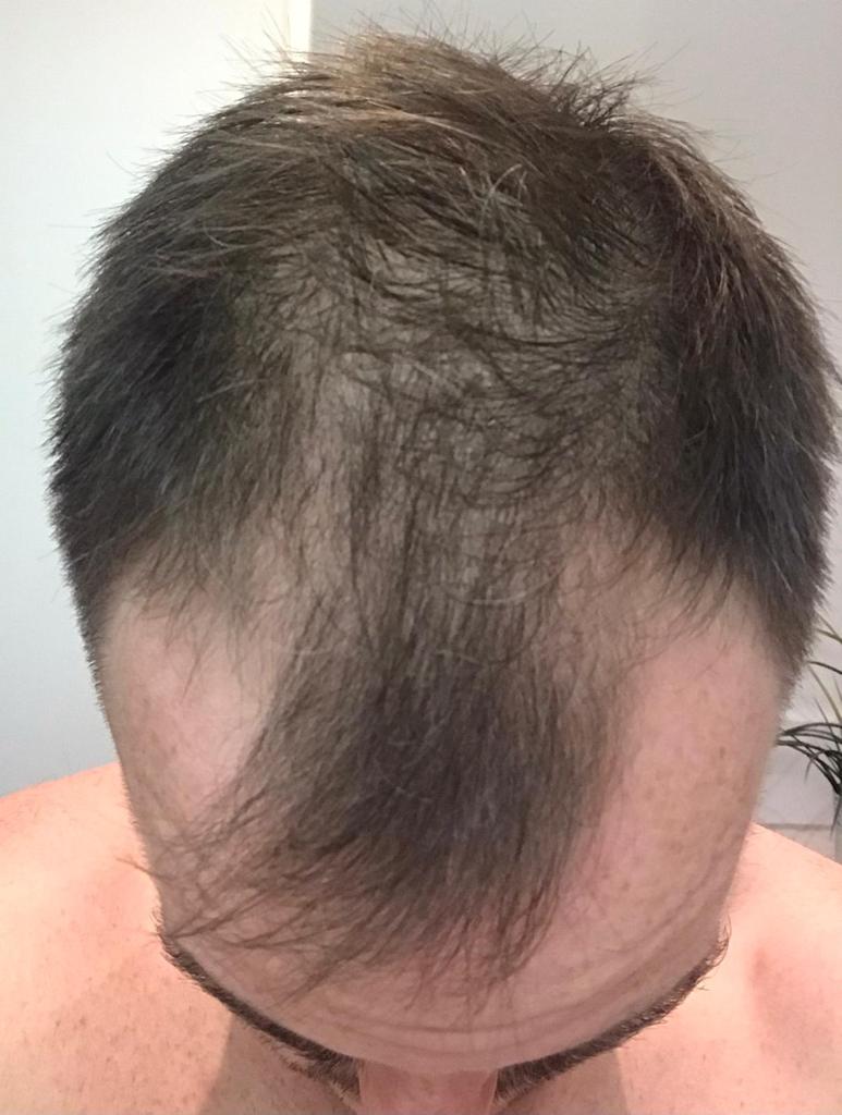 /foren/transplant/index.php/fa/58929/0/