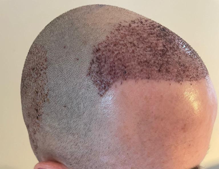 /foren/transplant/index.php/fa/58930/0/