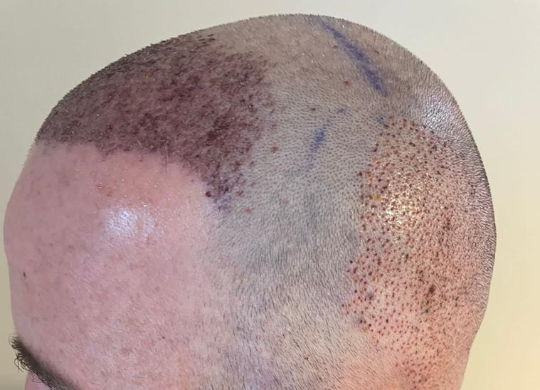 /foren/transplant/index.php/fa/58931/0/